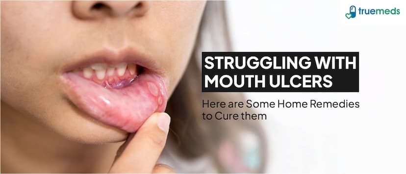 12 Home Remedies to Cure Mouth Ulcers