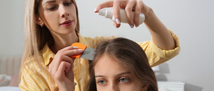 6 Effective Home Remedies for Hair Lice Treatment