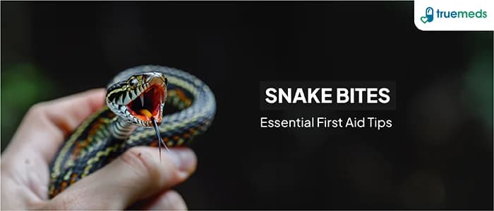 First Aid Steps for Snake Bite: What to Do and What to Avoid