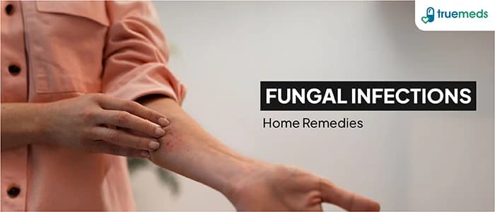 18 Simple Home Remedies For Fungal Infections