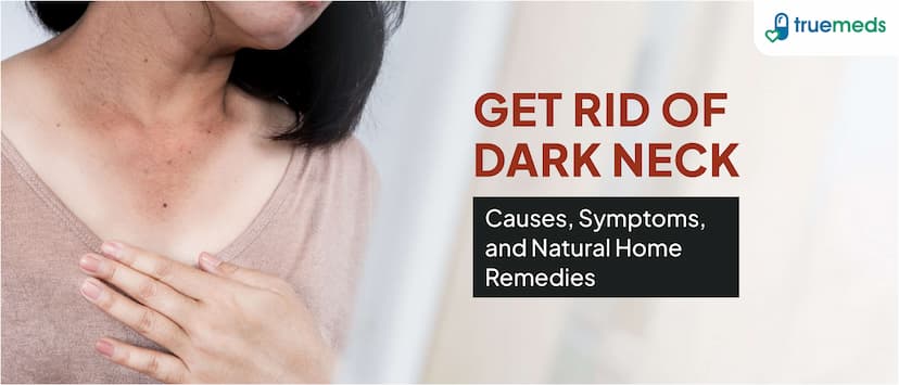 Natural Home Remedies to Get Rid of Dark Neck: Causes, Symptoms, and Treatments